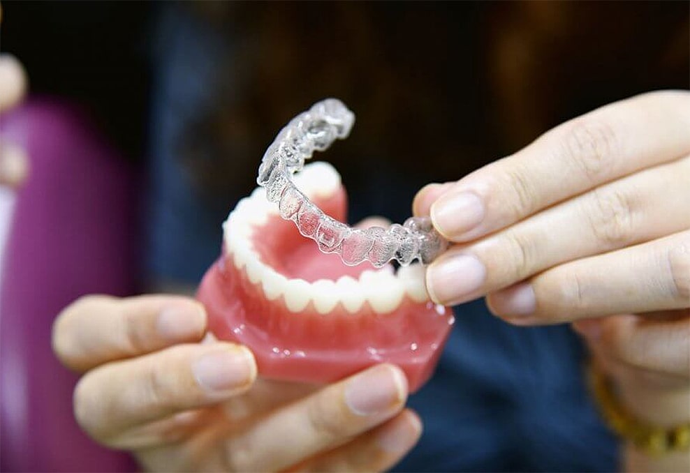 Benefits of Invisalign