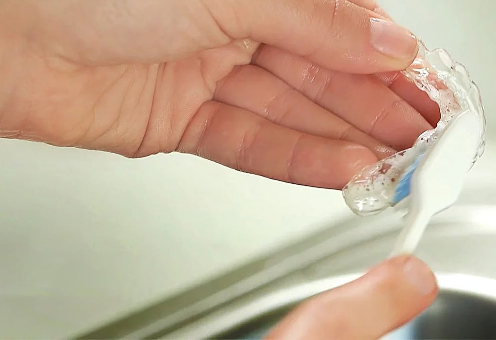 How are Retainers Cleaned?