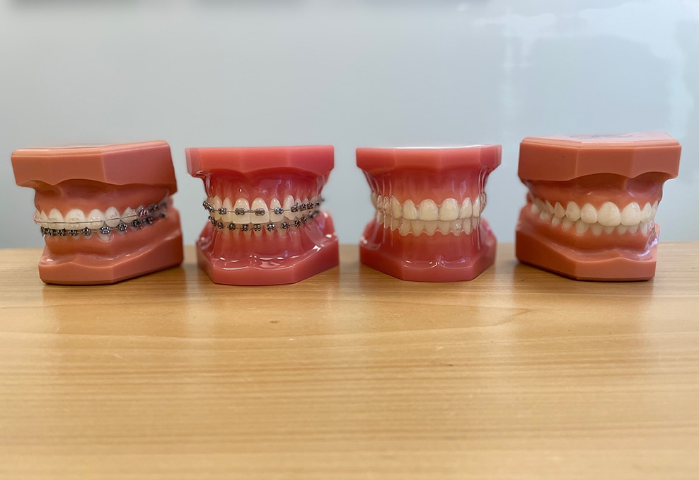 Is Invisalign Better Than Metal Braces?